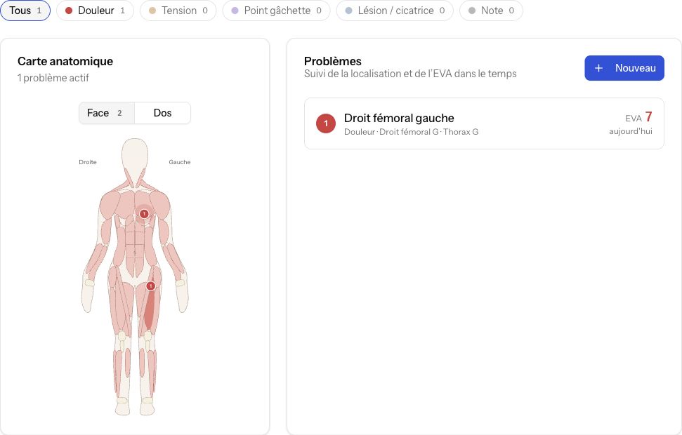 Schéma corporel SWAIFT : silhouette anatomique avec deux repères et un problème de douleur